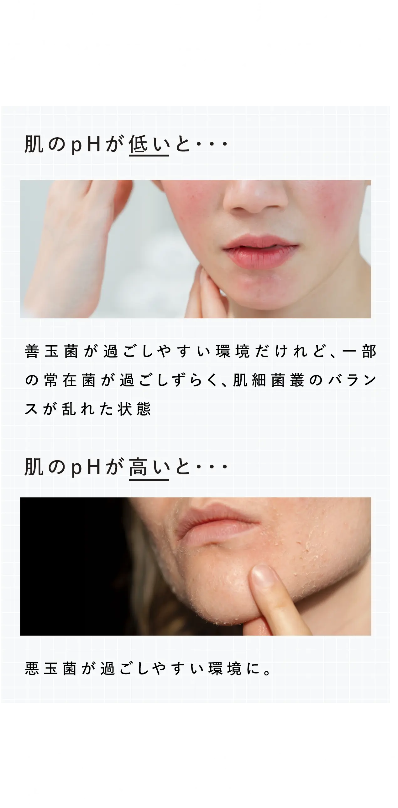 健康な人の肌のphに着目したスキンフローラバランス設計 【肌のphが低いと・・・】善玉菌が過ごしやすい環境だけれど、一部の常在菌が過ごしずらく、肌細菌叢のバランスが乱れた状態 【肌のｐHが高いと・・・】悪玉菌が過ごしやすい環境に。 理想的なpHバランスの整った肌で菌が棲みやすい状態へ