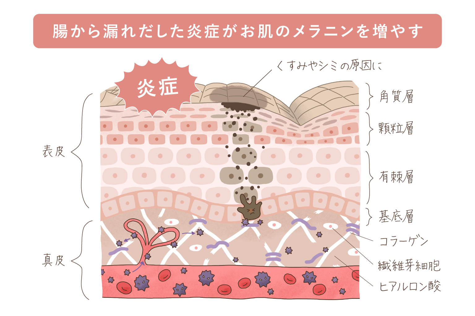 くすみやシミの原因