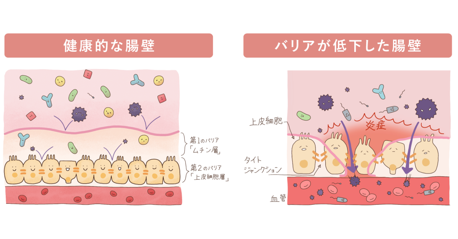 腸漏れ（リーキーガット）